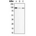 LifeSab™ PHKB Rabbit pAb (50 µl)
