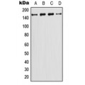 LifeSab™ PIK3C2G Rabbit pAb (50 µl)