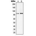 LifeSab™ PIK3R2 Rabbit pAb (50 µl)