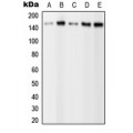 LifeSab™ PLCG2 (pY1217) Rabbit pAb (50 µl)