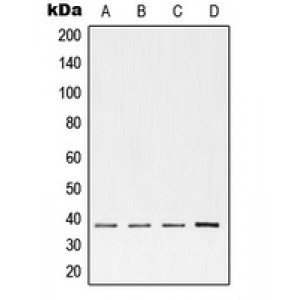 LifeSab™ cTnT Rabbit pAb (50 µl)