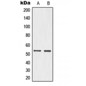 LifeSab™ p53 (pS15) Rabbit pAb (50 µl)