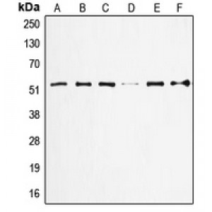 LifeSab™ p53 Rabbit pAb (50 µl)
