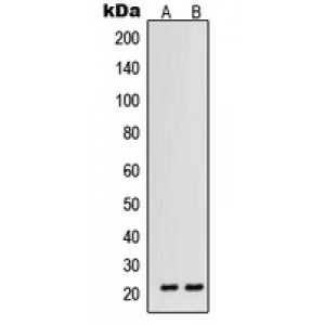 LifeSab™ VEGFB Rabbit pAb (50 µl)