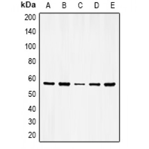 LifeSab™ Vimentin (pS56) Rabbit pAb (50 µl)