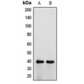 LifeSab™ ATP6V0D1 Rabbit pAb (50 µl)