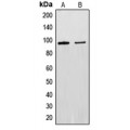 LifeSab™ EXO1 Rabbit pAb (50 µl)