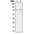 LifeSab™ CRSP7 Rabbit pAb (50 µl)