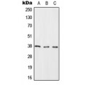 LifeSab™ RASSF2 Rabbit pAb (50 µl)