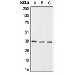 LifeSab™ RASSF2 Rabbit pAb (50 µl)