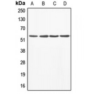 LifeSab™ ABI1 Rabbit pAb (50 µl)