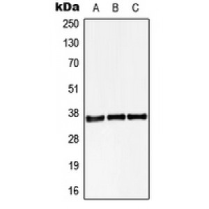 LifeSab™ STARD10 Rabbit pAb (50 µl)
