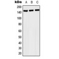 LifeSab™ NACAD Rabbit pAb (50 µl)