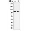 LifeSab™ PIP5K1C Rabbit pAb (50 µl)