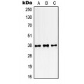 LifeSab™ SSBP2 Rabbit pAb (50 µl)