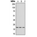 LifeSab™ RAB30 Rabbit pAb (50 µl)