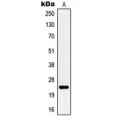 LifeSab™ KCNMB4 Rabbit pAb (50 µl)