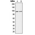 LifeSab™ GIT1 Rabbit pAb (50 µl)