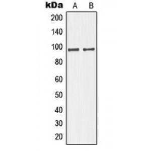 LifeSab™ GIT1 Rabbit pAb (50 µl)