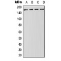LifeSab™ DROSHA Rabbit pAb (50 µl)