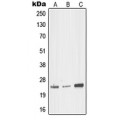LifeSab™ MED18 Rabbit pAb (50 µl)