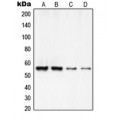 LifeSab™ RCC2 Rabbit pAb (50 µl)