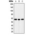 LifeSab™ UBFD1 Rabbit pAb (50 µl)