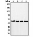 LifeSab™ RAD18 Rabbit pAb (50 µl)