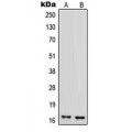 LifeSab™ MDA5 Rabbit pAb (50 µl)