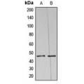 LifeSab™ NAP1 Rabbit pAb (50 µl)
