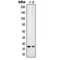 LifeSab™ ANT4 Rabbit pAb (50 µl)