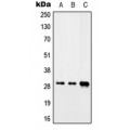 LifeSab™ CIP29 Rabbit pAb (50 µl)