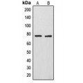 LifeSab™ ARHGAP18 Rabbit pAb (50 µl)