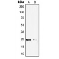 LifeSab™ TP53INP1 Rabbit pAb (50 µl)