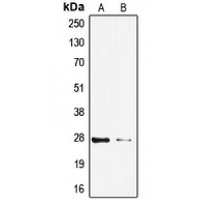 LifeSab™ TP53INP1 Rabbit pAb (50 µl)