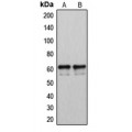 LifeSab™ CYP2U1 Rabbit pAb (50 µl)