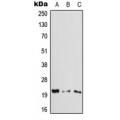 LifeSab™ CYGB Rabbit pAb (50 µl)