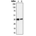 LifeSab™ LRG Rabbit pAb (50 µl)