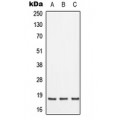 LifeSab™ SFT2D2 Rabbit pAb (50 µl)