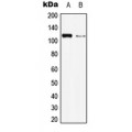 LifeSab™ BMPR2 Rabbit pAb (50 µl)