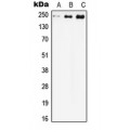 LifeSab™ Cav1.2 Rabbit pAb (50 µl)