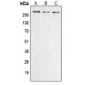 LifeSab™ Cav2.3 Rabbit pAb (50 µl)