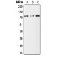 LifeSab™ DYNC1I2 Rabbit pAb (50 µl)