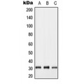 LifeSab™ GJB5 Rabbit pAb (50 µl)