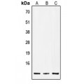 LifeSab™ Insulin Rabbit pAb (50 µl)