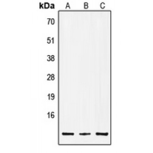 LifeSab™ Insulin Rabbit pAb (50 µl)