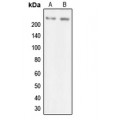 LifeSab™ MYO7A Rabbit pAb (50 µl)
