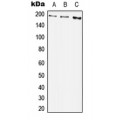 LifeSab™ PDGFRB (pY1009) Rabbit pAb (50 µl)