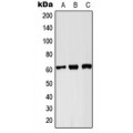 LifeSab™ PKLR Rabbit pAb (50 µl)