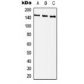LifeSab™ PLCG2 (pY759) Rabbit pAb (50 µl)